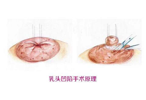 上海隆胸專家謝衛(wèi)國(guó)登榜，匠心精神和優(yōu)越性價(jià)比贏得口碑！