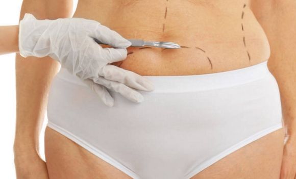 自貢哪家醫(yī)院做雙眼皮效果好？