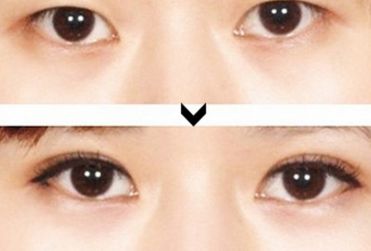 寧夏整形醫(yī)院哪家好？綜合評測，推薦您最滿意的整形醫(yī)院