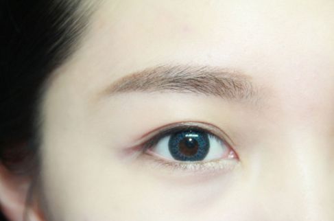 寧波哪家醫(yī)院割雙眼皮效果好？