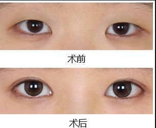 鄭州去黑點(diǎn)哪家醫(yī)院好？揭秘最受歡迎的黑點(diǎn)去除醫(yī)院