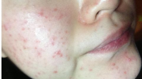 北京豐臺(tái)右安門(mén)醫(yī)院醫(yī)生好不好？服務(wù)口碑如何？