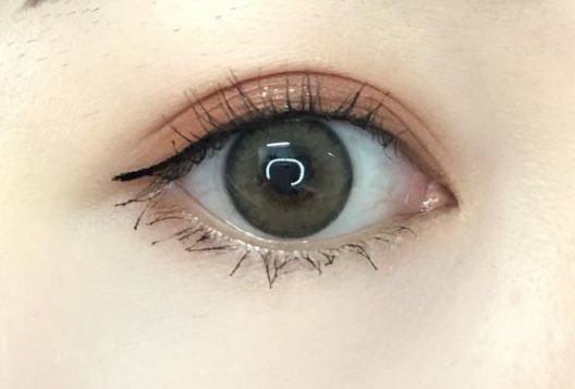 如何評價深圳和協(xié)醫(yī)院的脂肪填充手術(shù)？費用是多少？醫(yī)生資質(zhì)如何？