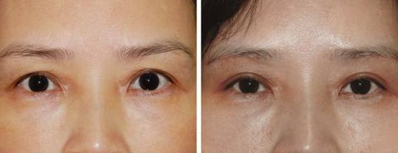 上海激光美容醫(yī)院排名及熱門選擇，哪家好？