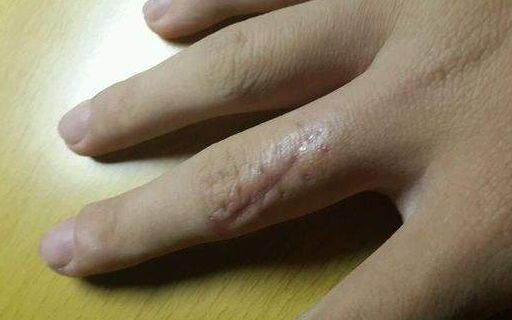 上海哪家醫(yī)院做肋骨鼻子整形手術(shù)好？