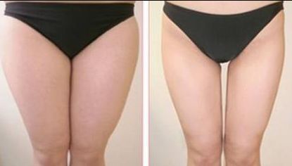 如何評價廣州珈禾整形醫(yī)院的口碑和質(zhì)量？