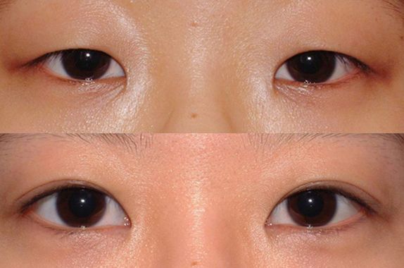 蘇州打瘦臉針哪家醫(yī)院好？2023年蘇州瘦臉針治療排行榜發(fā)布