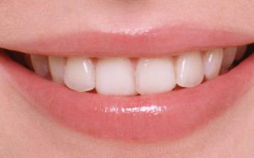 2023廣東激光祛斑美白評分10強專家(張勇、王友元、胡志奇穩(wěn)居榜首實力抗打)