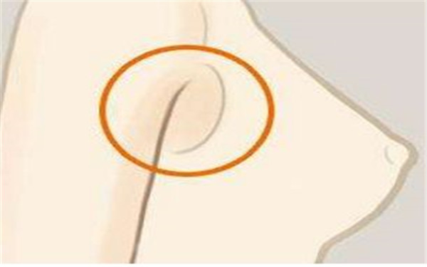 范巨峰醫(yī)生個(gè)人故事：驚艷雙眼皮案例與專業(yè)實(shí)力！