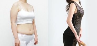 成都做雙眼皮，哪家醫(yī)院專業(yè)可靠？