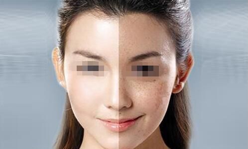 南昌哪家醫(yī)院做光子嫩膚好？選擇南昌哪家醫(yī)院光子嫩膚效果最佳
