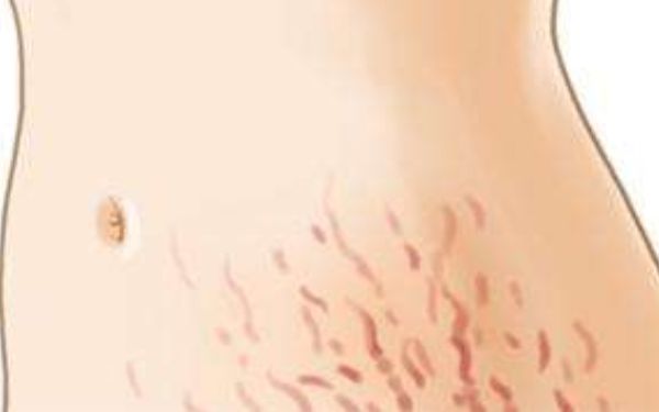 新鄉(xiāng)海迪醫(yī)療整形美容醫(yī)院值得信賴嗎？2023年價格表與醫(yī)生信息一覽