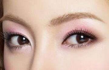 2023慈溪注射botox去魚尾紋口碑排名前10名專家(王中志、陸益新、陶衛(wèi)技術(shù)靠譜嗎)