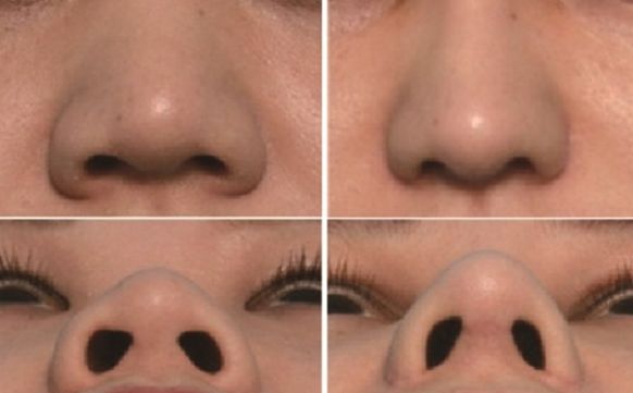 湖州市哪家醫(yī)院去疤痕好？專家推薦疤痕修復技術排行榜！