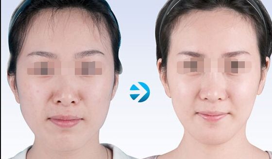 【2023北京哪家醫(yī)院做皮秒好？皮秒技術(shù)排行榜推薦】