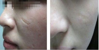 湖北棗陽整形醫(yī)院哪家最值得信賴？