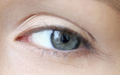 安醫(yī)大一附院整形科張林門診時間及雙眼皮案例分享