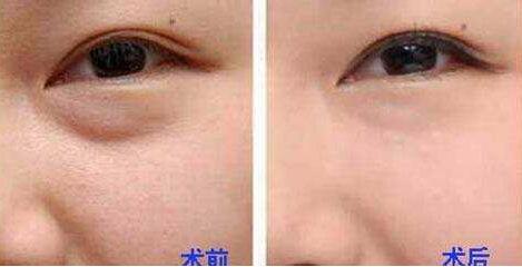 杭州整形美容界大咖PK，曾海峰、河?xùn)|鎬、高俊明，想知道磨骨哪個(gè)醫(yī)生靠譜？