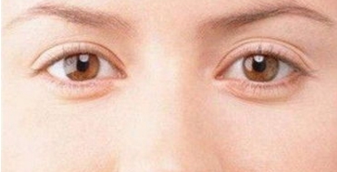 國(guó)內(nèi)哪些醫(yī)生在脂肪填充領(lǐng)域躋身專家級(jí)別？張懷軍、顧云鵬、王自謙等名醫(yī)榜上有名！