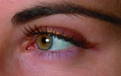 上海哪家醫(yī)院治療疤痕效果好？上海三甲疤痕醫(yī)院哪家最受歡迎？