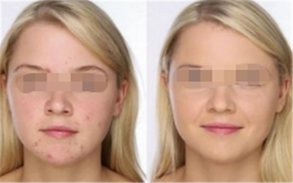 東莞哪家醫(yī)院做眼袋好？排名第一的權(quán)威醫(yī)院推薦