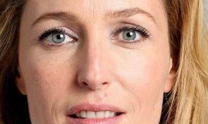 北京協(xié)和醫(yī)院整形科的拉皮效果好嗎？