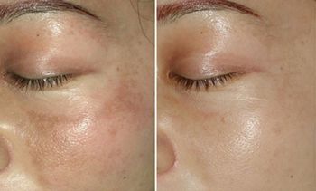 哈醫(yī)大二院整形科怎么樣？哈醫(yī)大二院整形科簡介|醫(yī)生團隊|口碑評價！