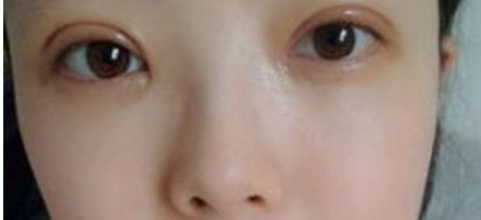 重慶隆鼻整形排名前三的醫(yī)院有哪些？