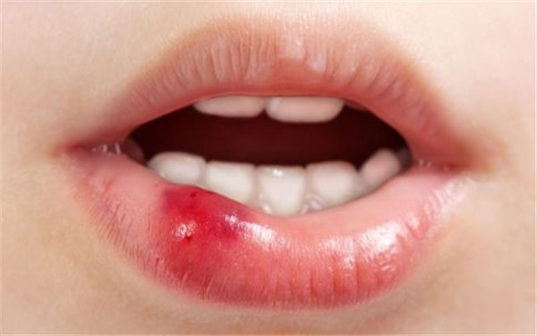 2023成都Liposuction360°水動力吸脂醫(yī)生在榜名單前十名(張?zhí)煲?、車尚勉、曾春梅都是?shí)力派)