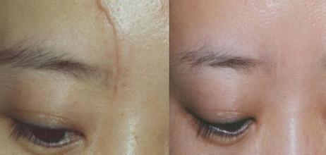 2023上海面部膨體填充推薦前十醫(yī)生(王威、呂桂良、胡永金口碑不賴放心選擇)