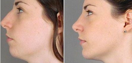 上?？簇惪损肽募裔t(yī)院好？選個(gè)靠譜的！