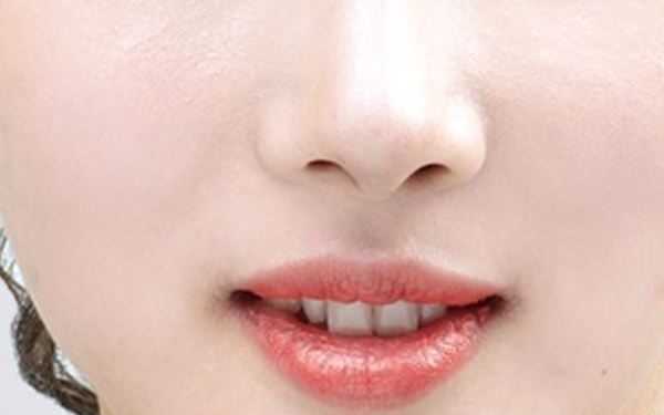 東莞市人民醫(yī)院劉玉生面部整形術(shù)效果如何？