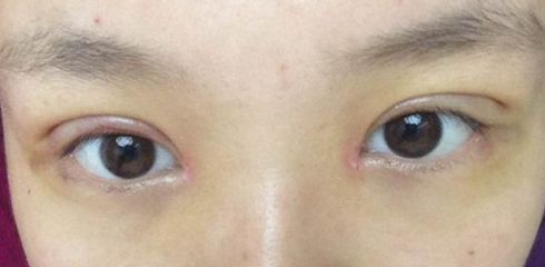 徐州做拉皮哪家醫(yī)院好？一起來(lái)看看徐州市最受歡迎的做拉皮醫(yī)院