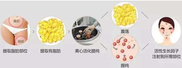 哈爾濱哪家醫(yī)院的去皺針效果好？