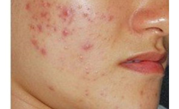 想了解寧波慈溪圣愛醫(yī)院醫(yī)療美容整形科價格表？醫(yī)生口碑如何？