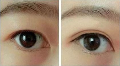 合肥哪家整形醫(yī)院好口碑好服務(wù)好值得推薦？