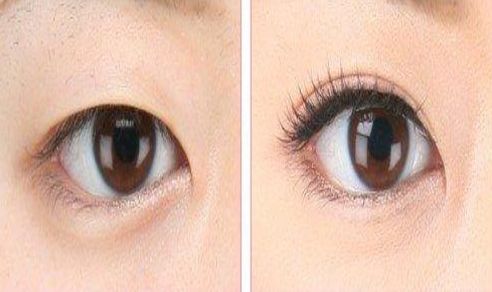 南昌市哪家醫(yī)院去痘好？專家推薦的南昌市治療痘痘的一流醫(yī)院有哪些