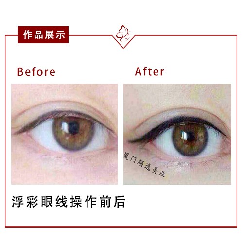 合肥割雙眼皮醫(yī)生排名及專業(yè)醫(yī)院介紹