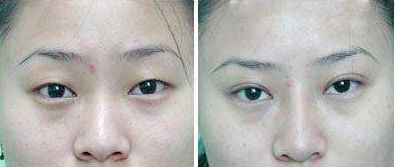 武警廣西總隊醫(yī)院怎么樣？武警廣西總隊醫(yī)院簡介|醫(yī)生團隊|口碑評價！