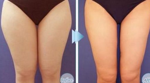 青松星范醫(yī)療美容整形門診部的醫(yī)生和技術(shù)水平怎樣呢？