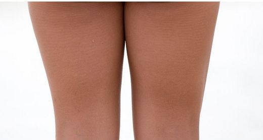 成都哪家醫(yī)院做眼袋好，治療眼袋效果明顯的醫(yī)院有哪些