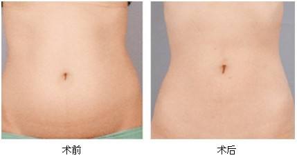 2023襄陽臀部填充玻尿酸權(quán)威專家榜單前10名(陳敬武、劉妮娜、莊成全口碑價格整理發(fā)布~)