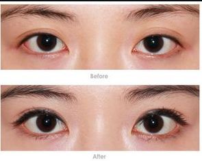 鄭州整容醫(yī)院哪家好？教你如何選擇適合自己的整容醫(yī)院