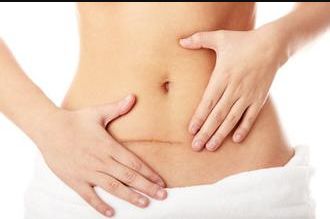 遼陽豐胸整形醫(yī)院哪家好？挑選醫(yī)院應(yīng)注意哪些關(guān)鍵點(diǎn)？