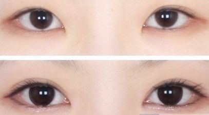 深圳市哪家美容醫(yī)院好？全面評測揭曉，服務(wù)和口碑都在線！