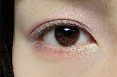 王世虎拉皮和脂肪填充的效果如何？有哪些多樣化的項(xiàng)目值得選擇？技術(shù)是否可靠可證？