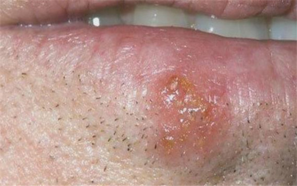 2023廣西生物注射祛皺正規(guī)醫(yī)生榜單前10位(李冰、馬珂、韓志強(qiáng)看看哪一家更適合？)