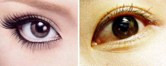 安徽省哪家醫(yī)院割雙眼皮效果最好，技術(shù)最先進(jìn)，口碑最好？