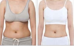 馬曉輝：301醫(yī)院整形專家正式亮相！正頜手術效果搶眼，手術案例推薦！