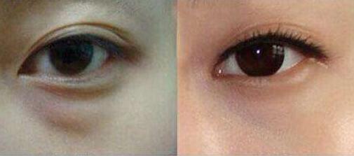 上海更受推薦的隆胸專家排行榜！王濤、江華等5位魅力無(wú)限，非?？孔V！